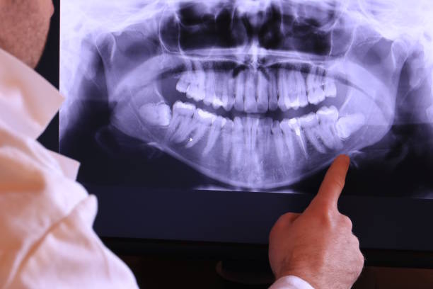 Best Emergency Cosmetic Dentistry (e.g., broken veneers) in Cave Springs, AR